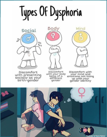 Gender dysphoria