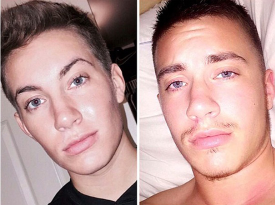 FTM transgender Jaimie Wilson's facial changes from Testosterone