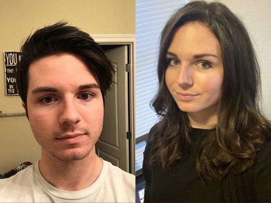 MTF face changes with the aid of feminizing hormones