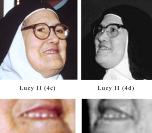 The teeth or dentures of sister lucy II