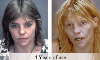 Consequences of using meth
