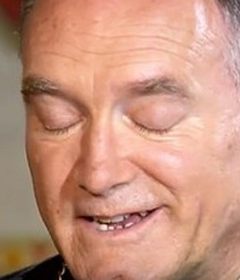 Bernard Fellay