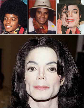 Pictures showing Michael Jackson before and after surgeries